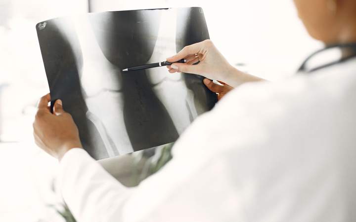 Médecin en blouse blanche analysant une radiographie avec un stylo