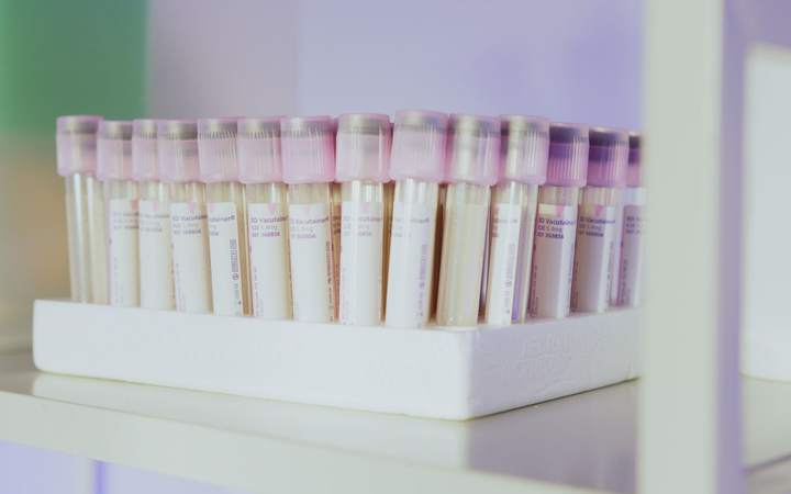 Tubes de prélèvement sanguin alignés sur un portoir de laboratoire d’analyses